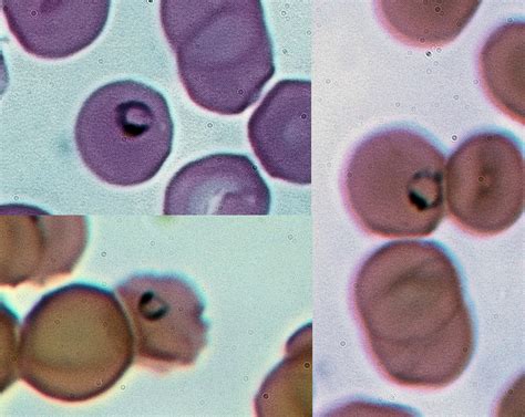  Plasmodium: Un Parassita Minuscolo Con un Impatto Globale Sconcertante!