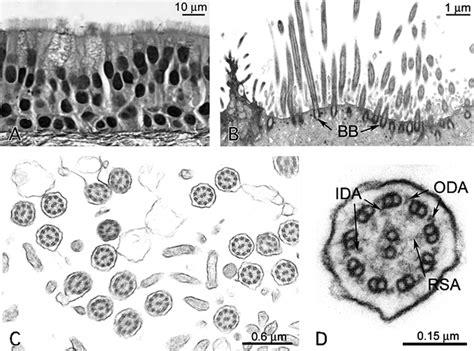  Xerodromella! Una Ciliophora cheSfugge alla Normale Locomozione Ciliare